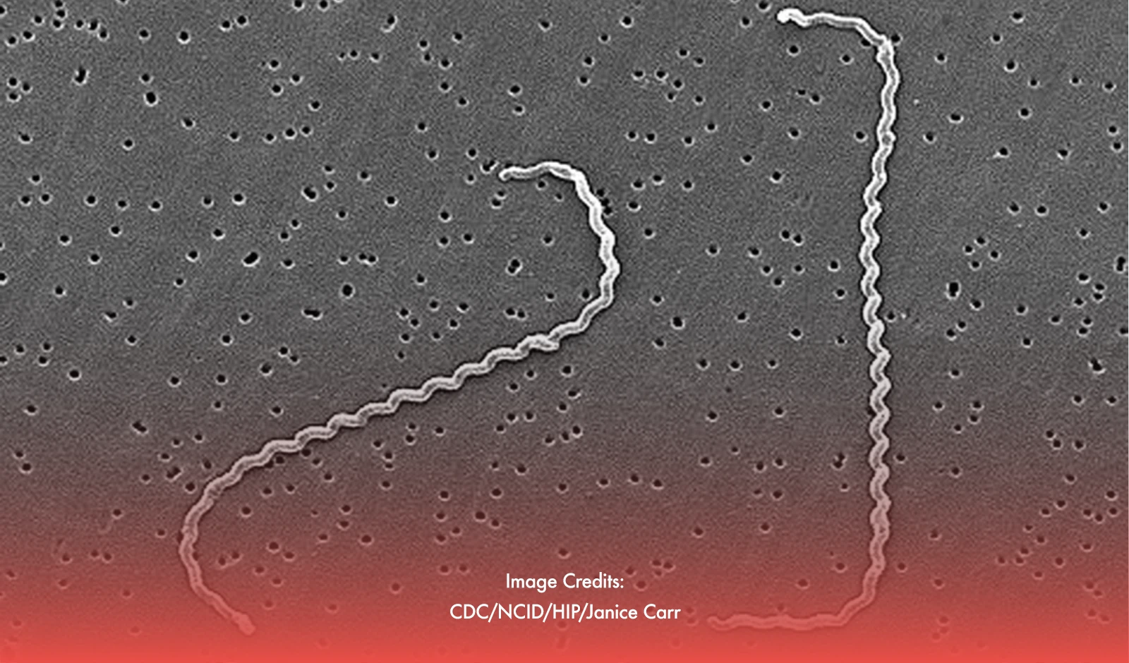 Leptospirosis Cases Increase By 16% Since Start Of 2024