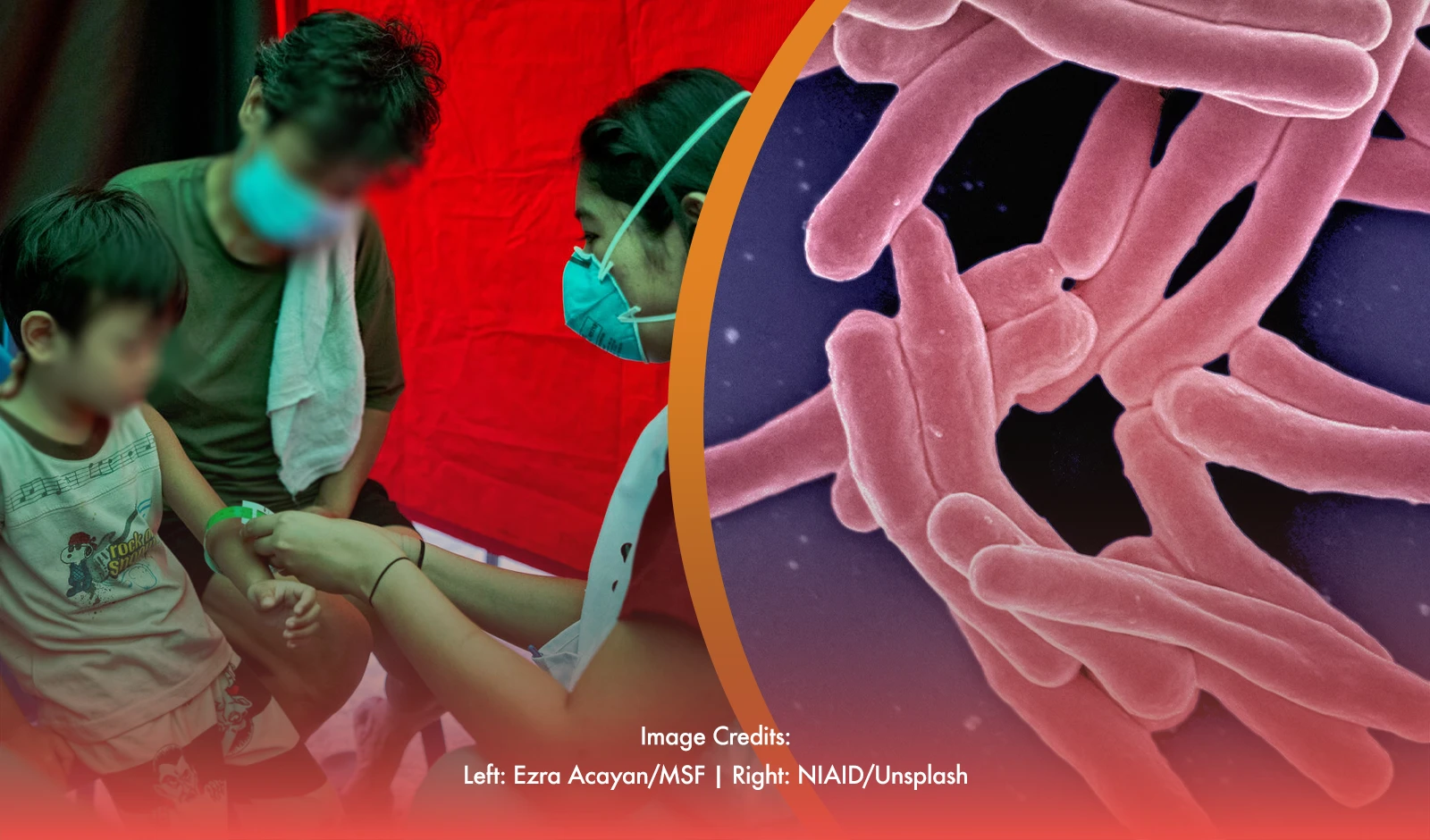 PH Among the Top 5 for TB Cases: A Call For Action