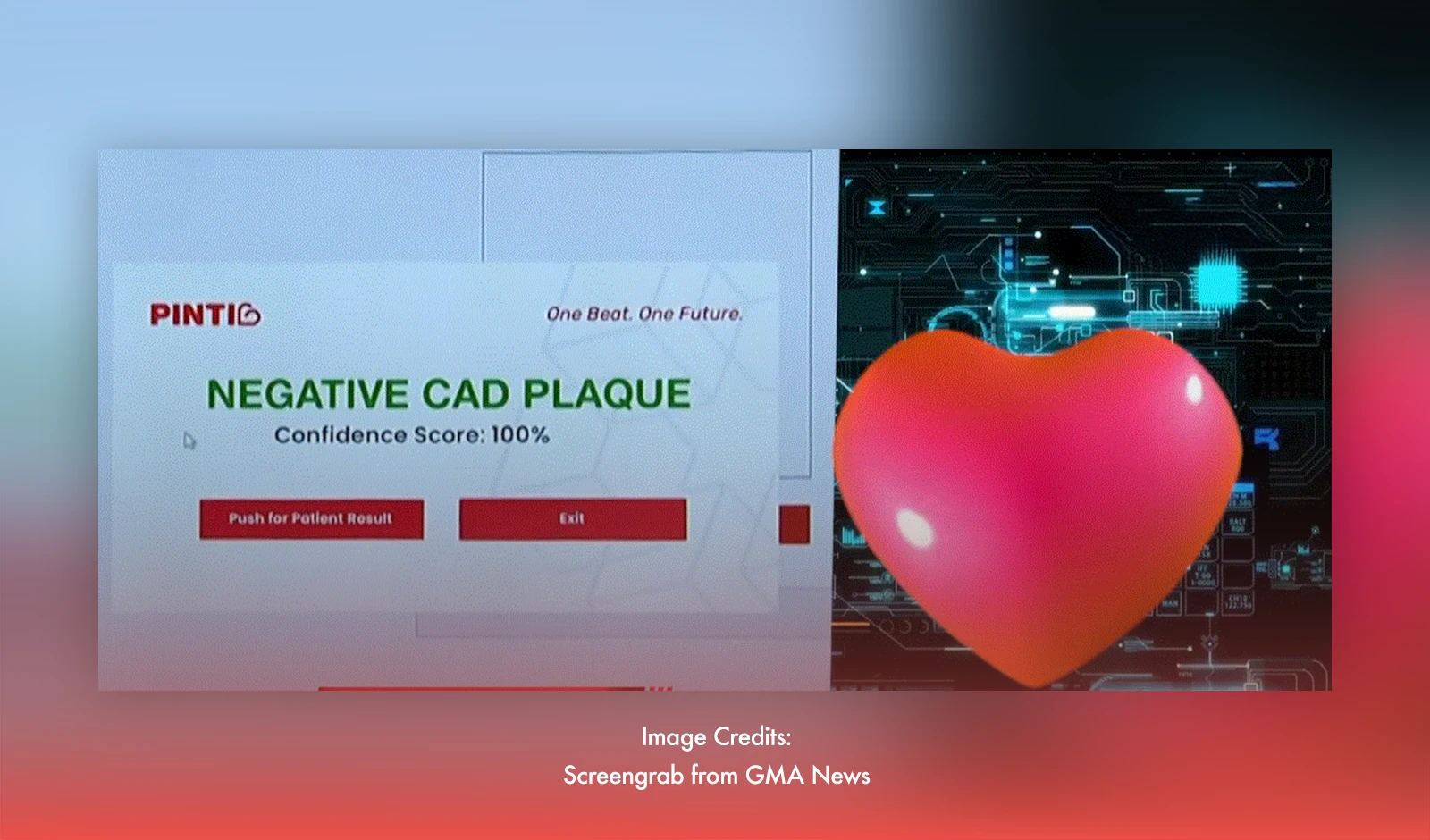 Quezon City Students Create AI Tool To Detect Heart Plaque Early