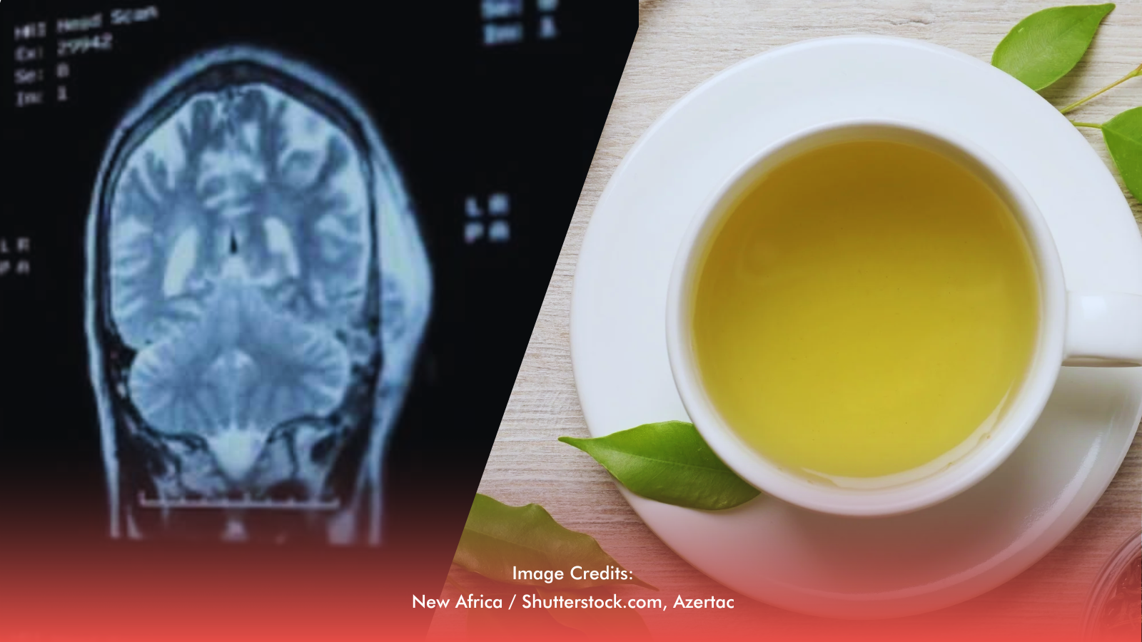 Green Tea Compound May Help Protect Vs. Alzheimer’s, Study Finds